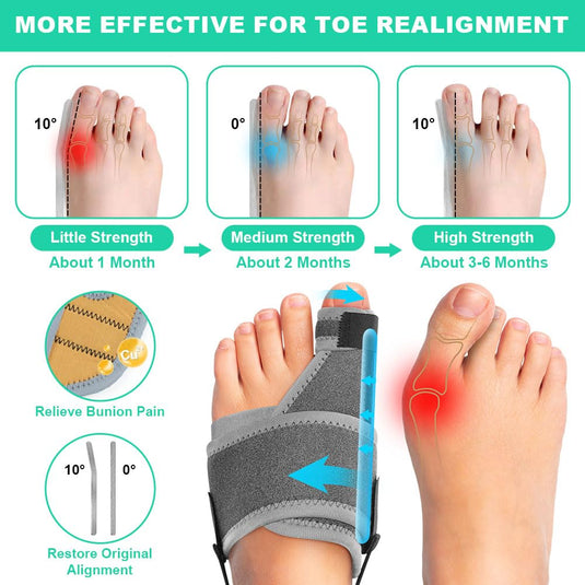 Hallux valgus correctors 2 stuks met verstelbare teenbandage en aluminium spalken – teenspreiders – voetondersteuning - happygetfit.com